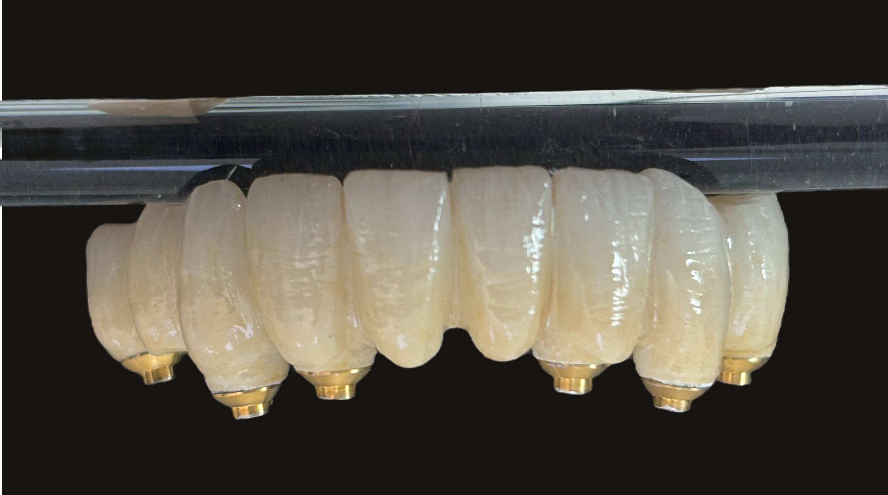 Trabajos de estética dental